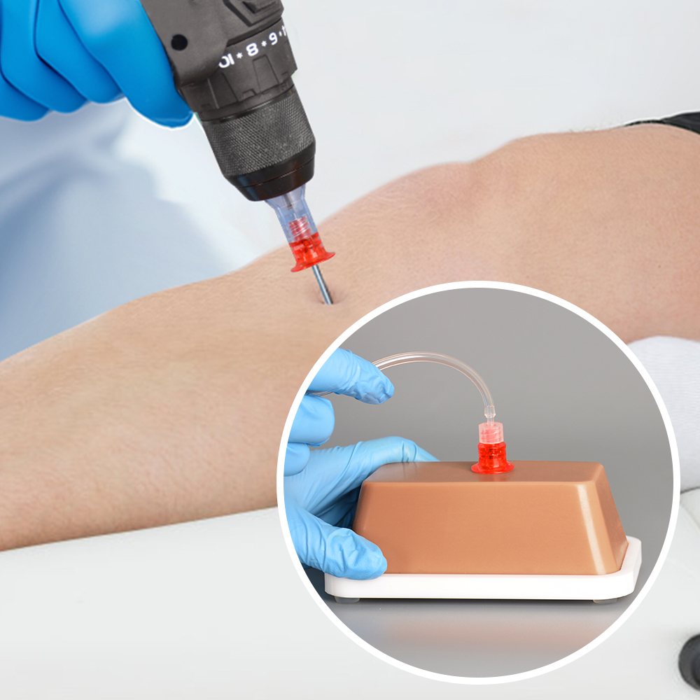 Hands-On IO Training Model for Nurses