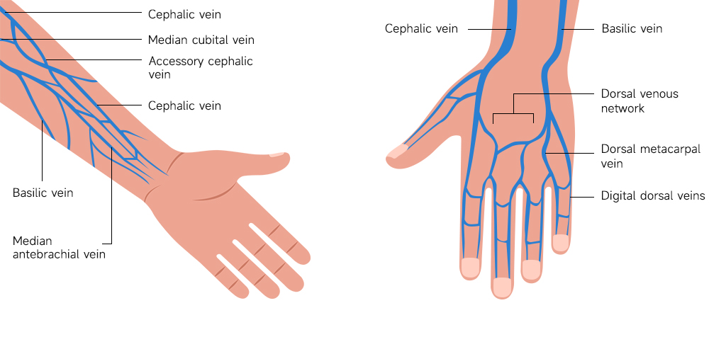 Intravenous Injection Sites on Human Hand