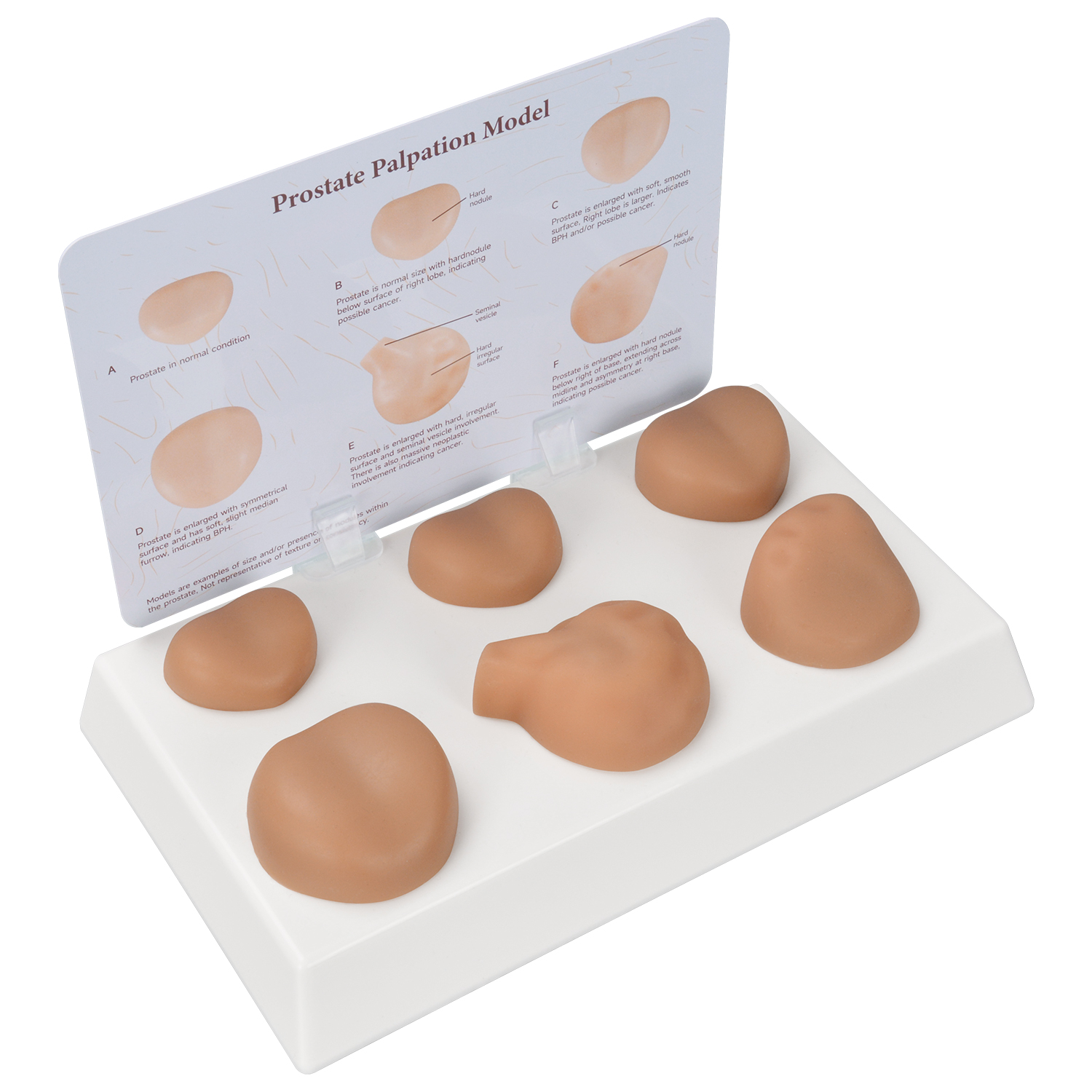 6-Stage Prostate Palpation Trainer & Pathology Simulation Model