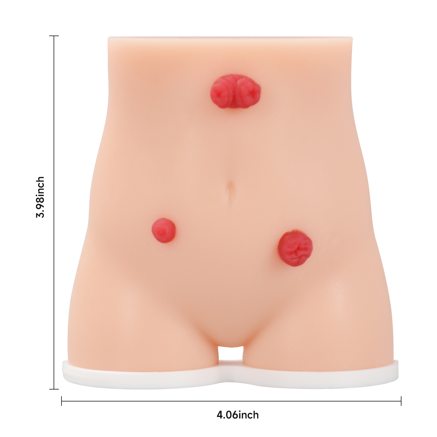 Handheld Stoma Demonstration Model