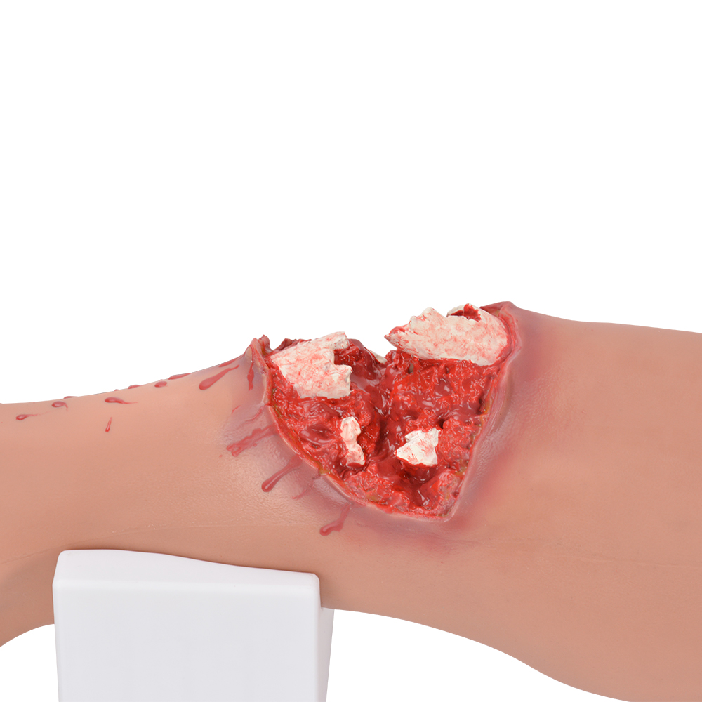 Full Leg Open Fracture Hemorrhage Control Trainer