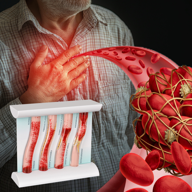 Visual LDL Cholesterol Model For Classroom Training