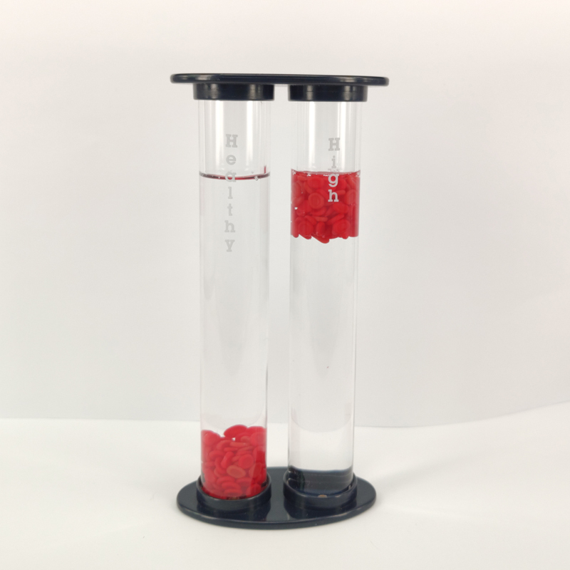 Hyperglycemia vs. Healthy Blood Vessel Model
