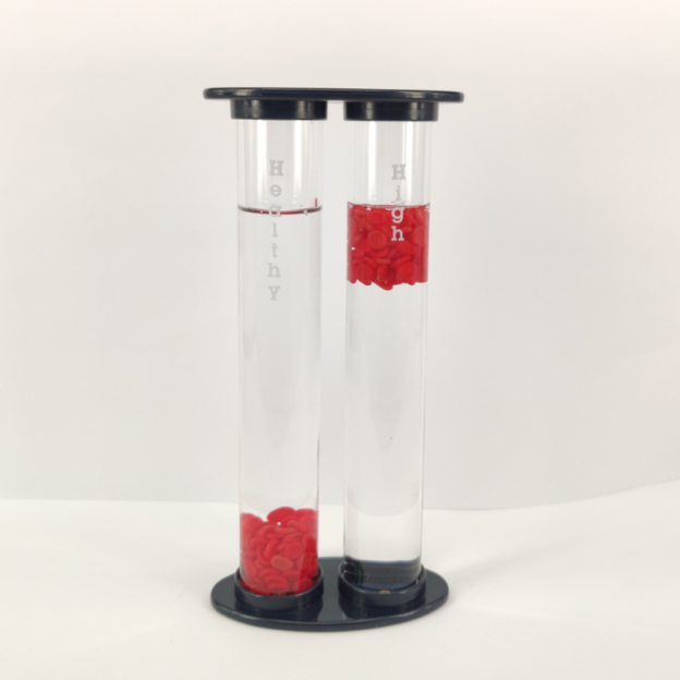 Hyperglycemia vs. Healthy Blood Vessel Model