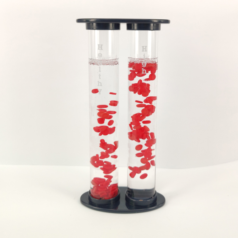 Hyperglycemia vs. Healthy Blood Vessel Model