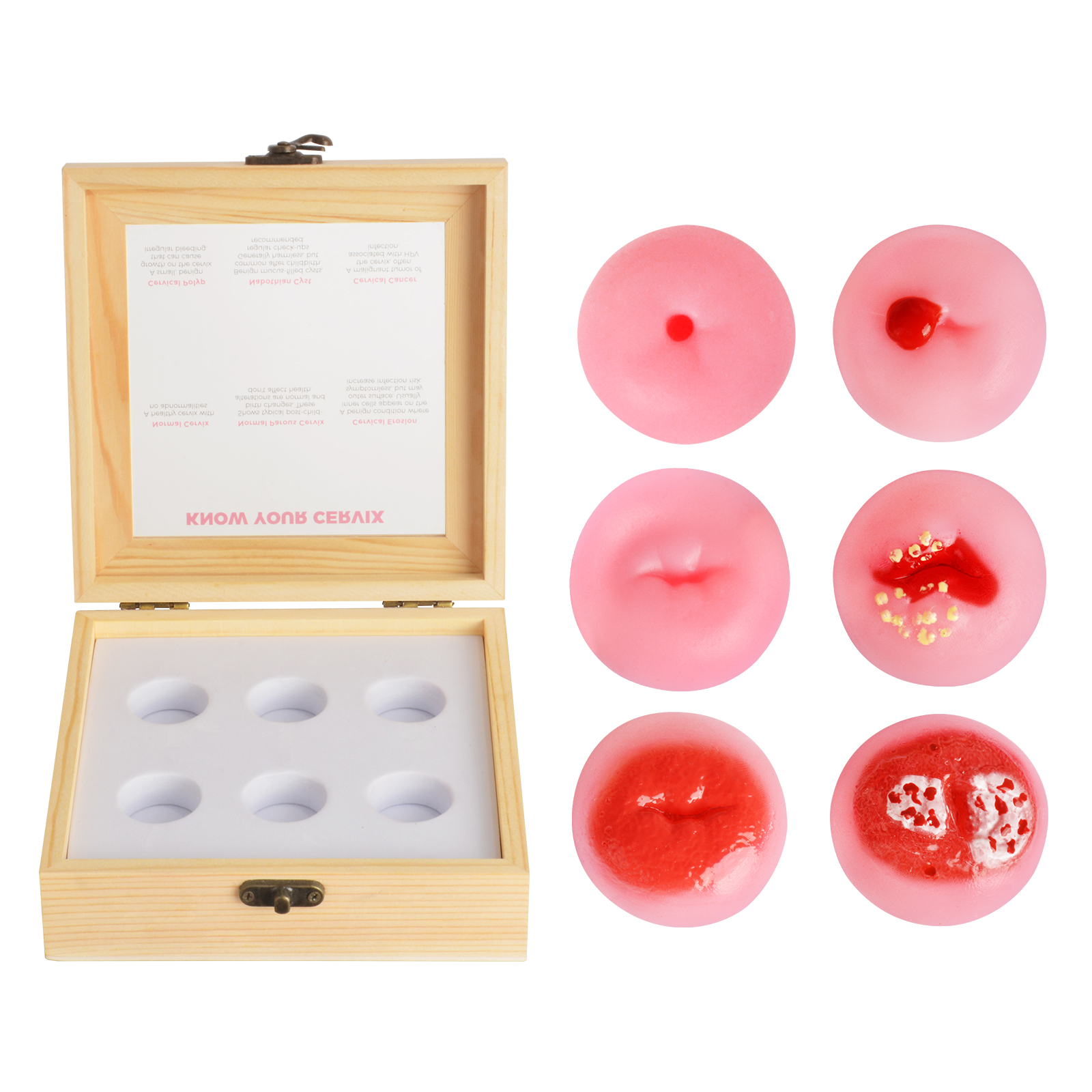 Six Cervical Condition Replicas Displayed In Wooden Box