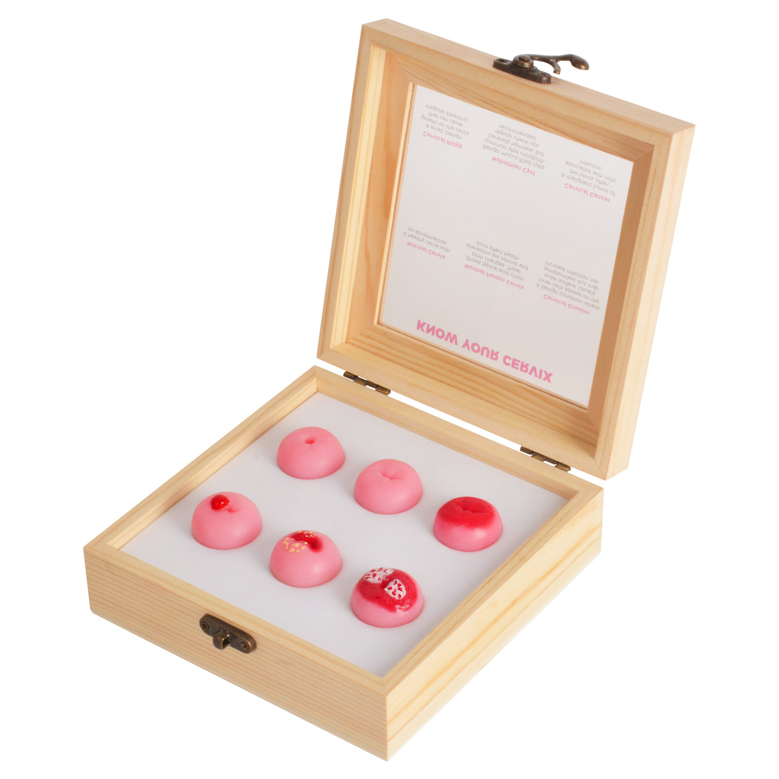 Cervical Health Education Model With Six Realistic Replicas