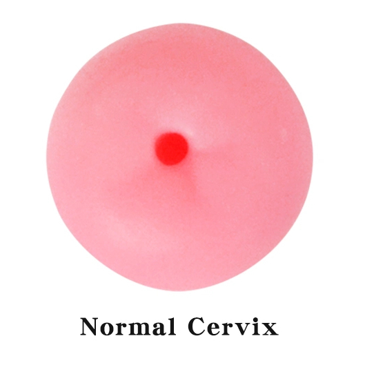 Normal Cervix Picture
