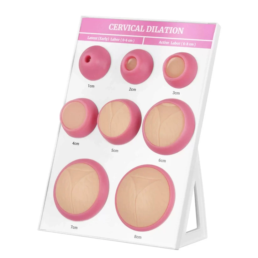 Cervical Dilation Display Model with 1-8cm