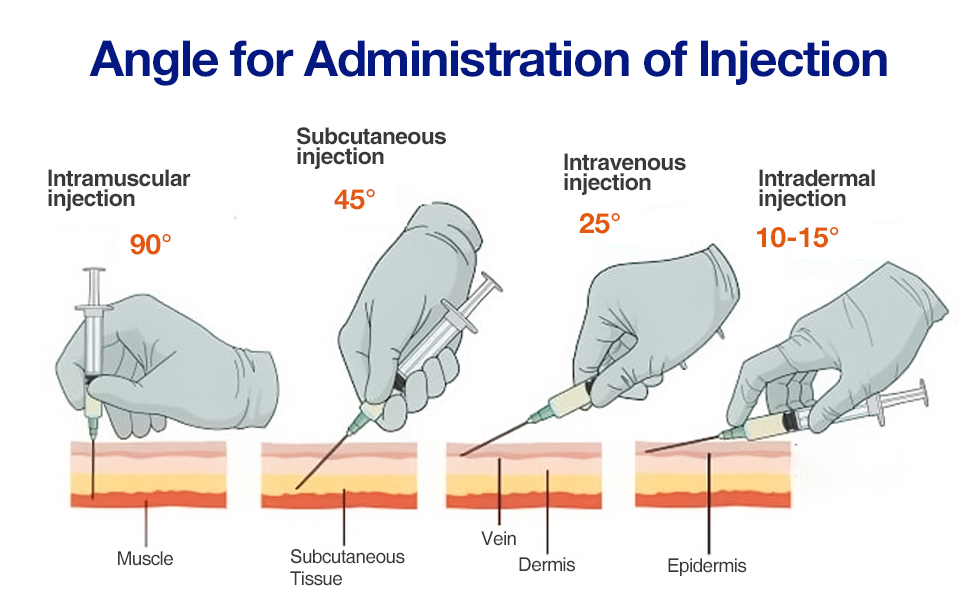 Different Types of Injection Angles