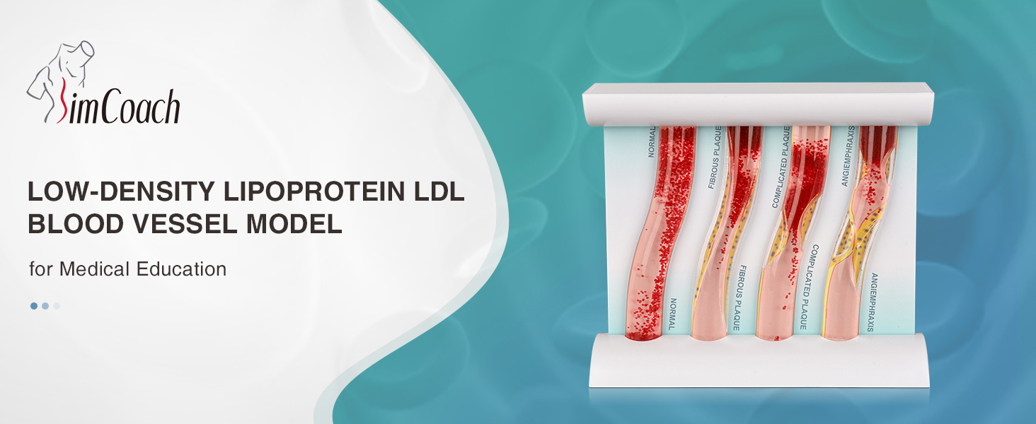 Low-Density Lipoprotein LDL Blood Vessel Model