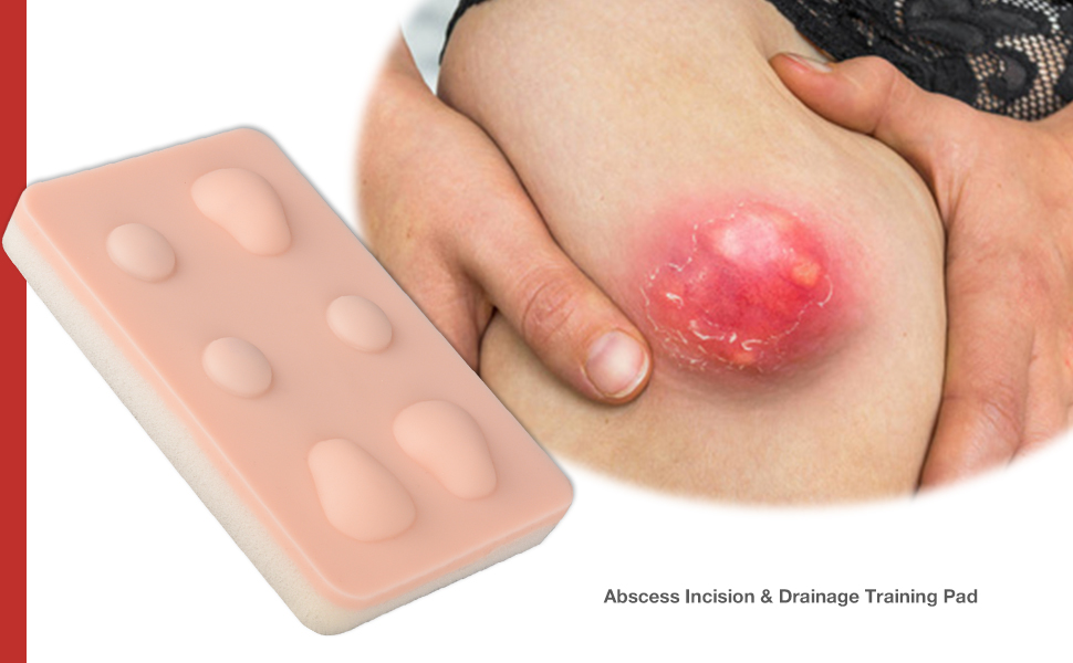 Sebaceous Cyst Removal Simulation Pad