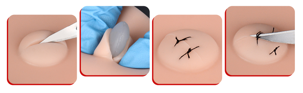 Silicone Pad with Expressible Pus for I&D