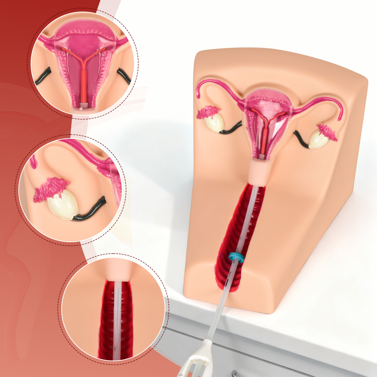 IUD Insertion And Removal Practice Gynecology Trainer