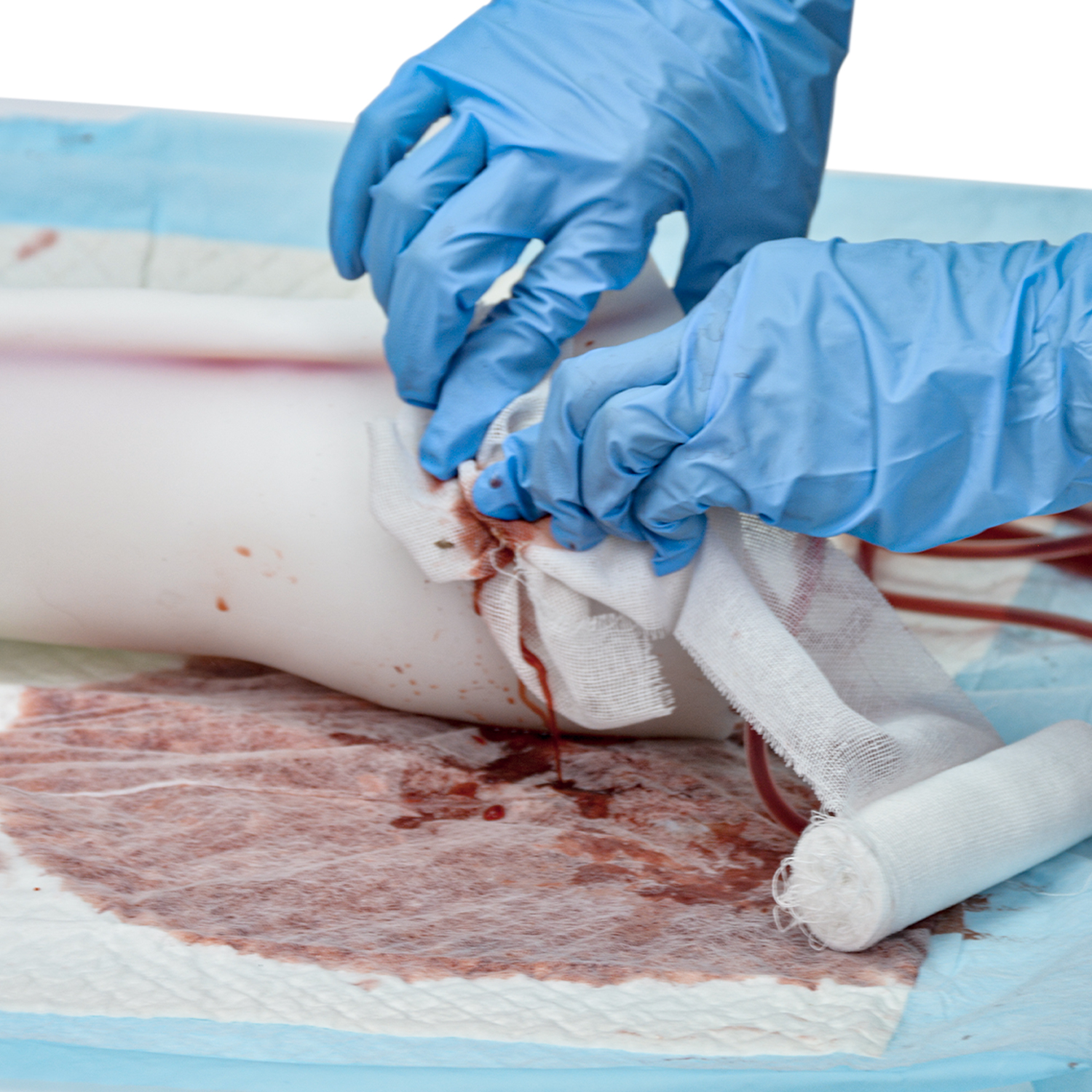 Hemorrhage Control Practice On Transparent Arm Model