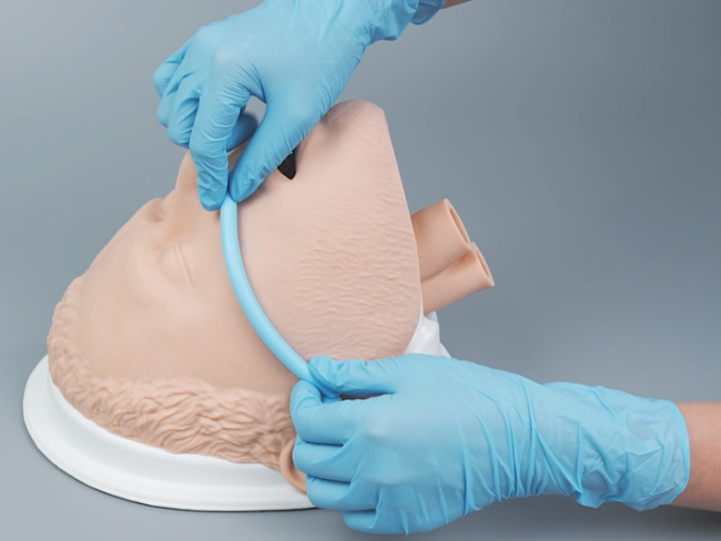 Choose the Right NPA Size Method