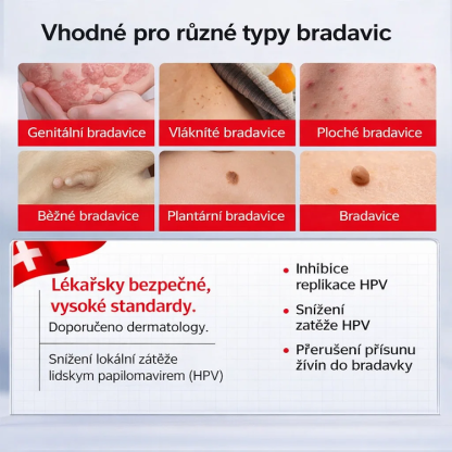 【Jednosekundový odstraňovač bradavic】Krém na odstranění bradavic