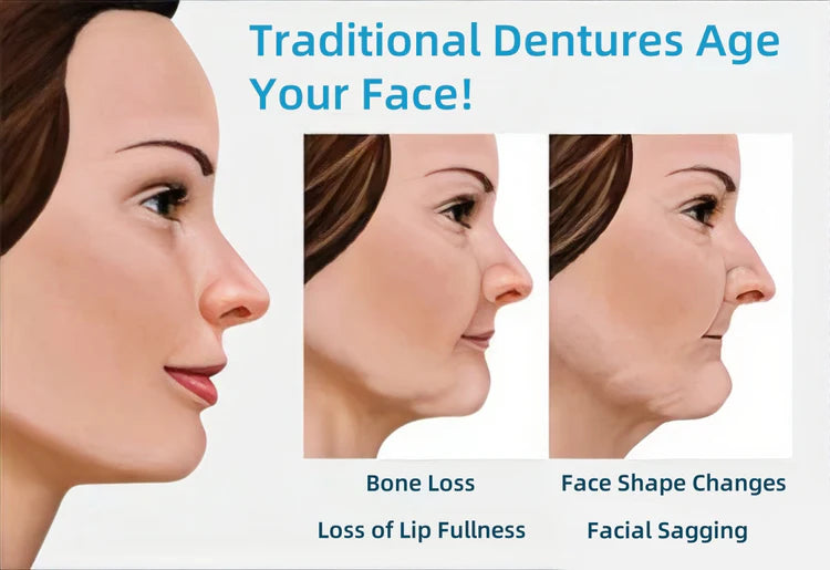 FOMONEST™ Medical Full Denture with Strong Suctiond Custom-Fit Full Functional Dentures