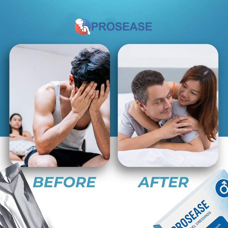 ProsEase - Gel | Zlepšený výkon a silnější erekce již po jedné aplikaci