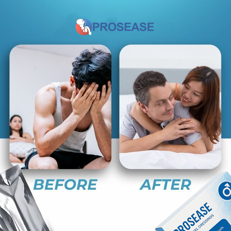 ProsEase - Gel | Zlepšený výkon a silnější erekce již po jedné aplikaci