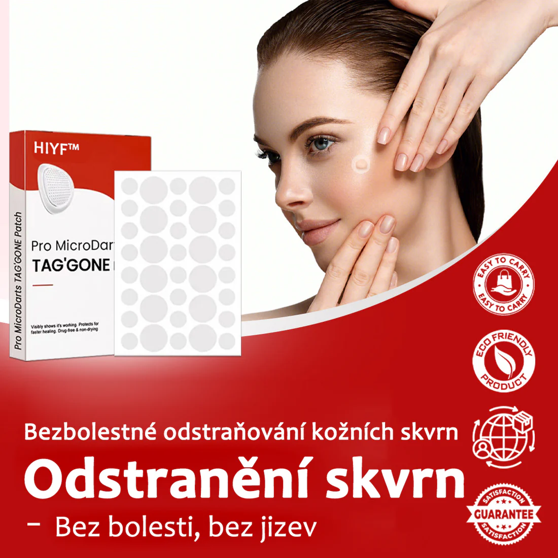 Náplasti na odstránenie kožných výrastkov KUBOZN® Pro MicroDarts TAG'Gone