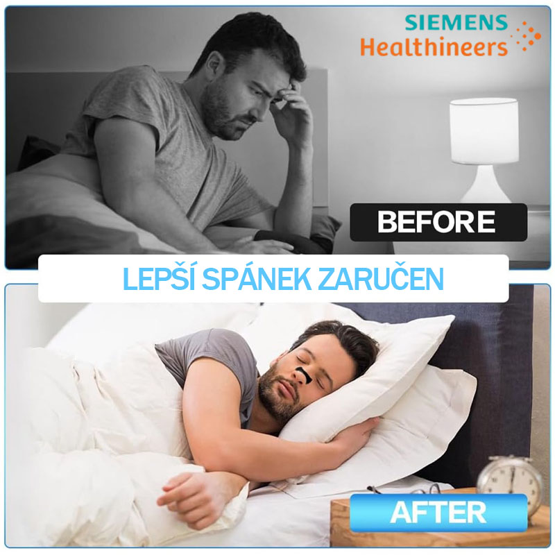 Startovací sada magnetických nosních proužků Siemens Breathing a 15denní zásoba Extra silný