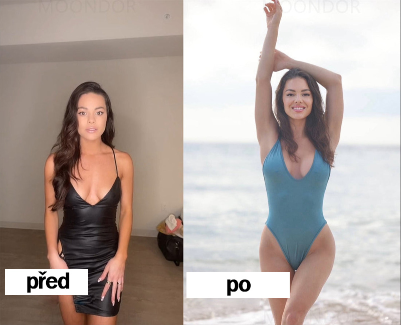 💎【Oficiální vlajkový obchod】𝐇𝐔𝐃𝐑𝐎𝐒® Náplasti s mateří kašičkou pro zvětšení prsou. Bezpečné pro použití během kojení.