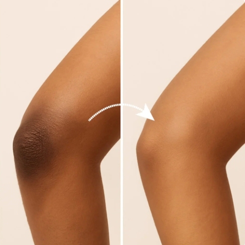 🔥Sada 2 lahví 💖Rozjasňující přípravek pro intimní partie SnowBleach™