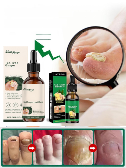 Introducing our all-natural plant-based nail care solution! Our formula addresses onychomycosis (fungal nail infection) at its root, promoting healthy nail growth.