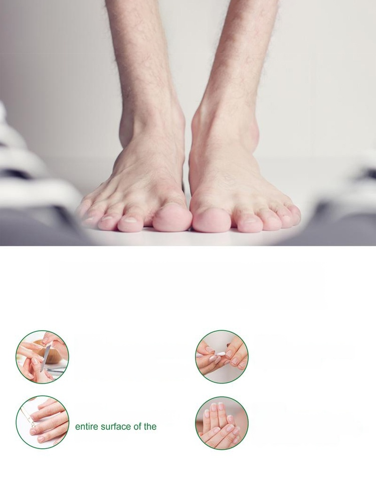 Introducing our all-natural plant-based nail care solution! Our formula addresses onychomycosis (fungal nail infection) at its root, promoting healthy nail growth.