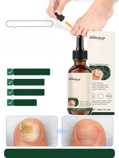 Introducing our all-natural plant-based nail care solution! Our formula addresses onychomycosis (fungal nail infection) at its root, promoting healthy nail growth.