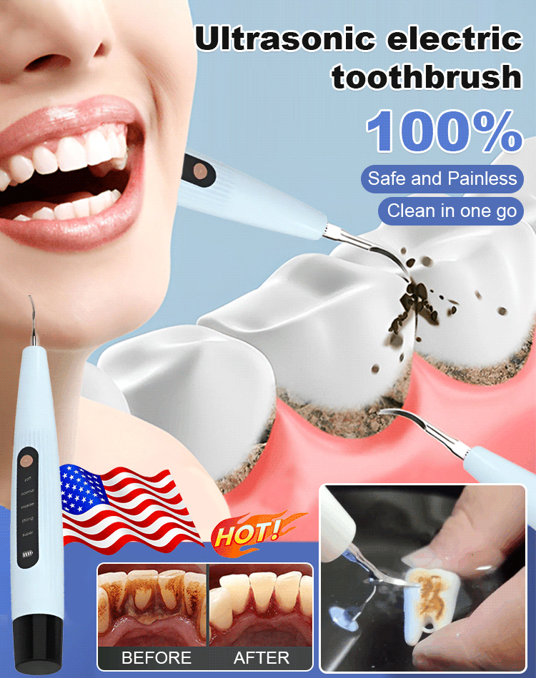 🔥 32000Hz medical-grade ultrasonic micro-vibration precisely removes tartar from between teeth and below the gum line, restoring teeth to their original cleanliness.