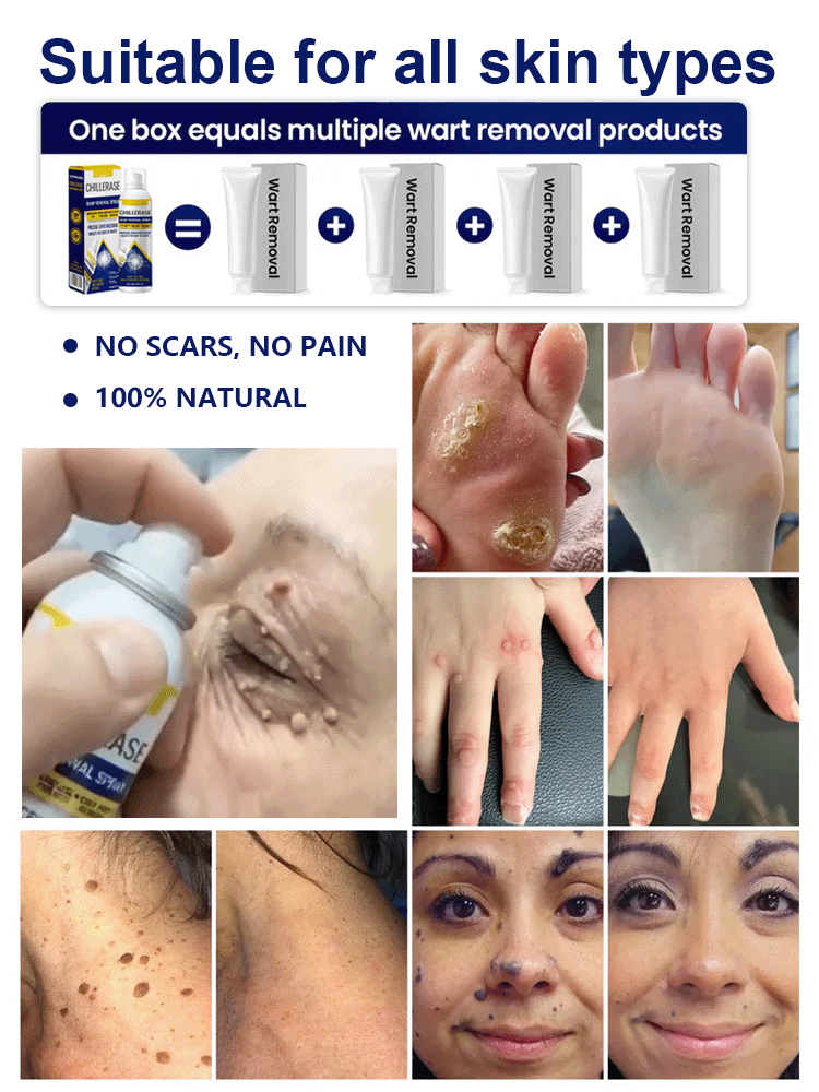 Cooling Soothing Spray