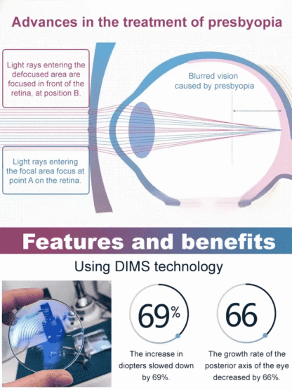 【✨️ Intelligent Zoom from -7.00 to +7.00】Self-adjusting glasses 📎 No eye exam required.