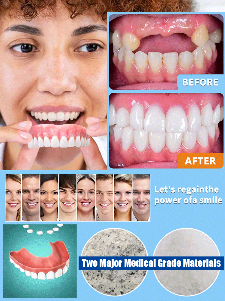 Imported simulation braces, dentists strongly recommend simulation correction braces