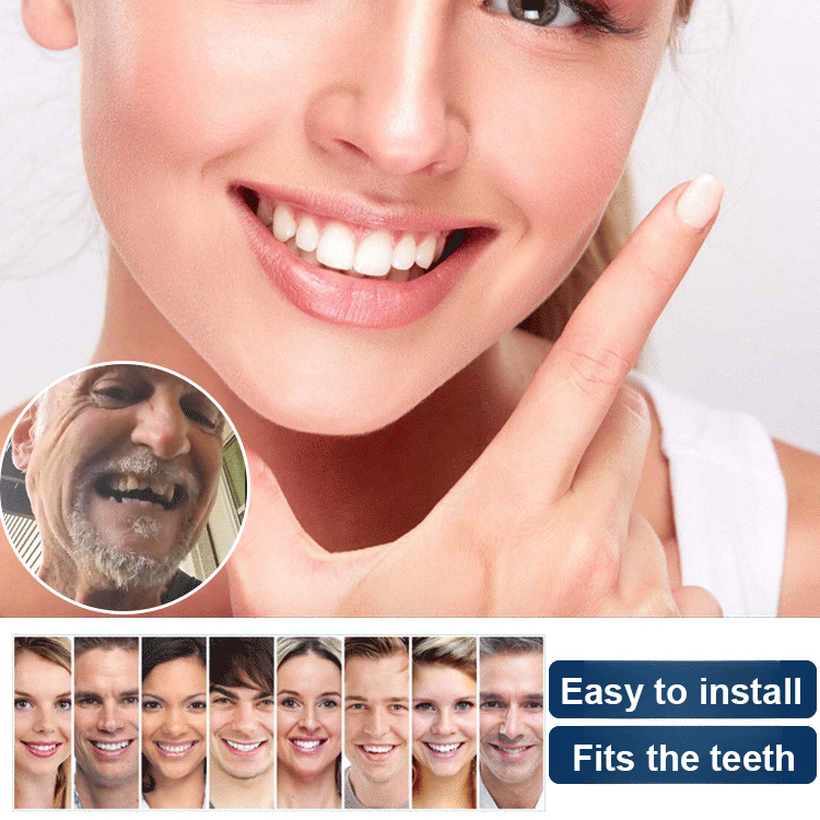 Dentures and Dentures Makeover Kit