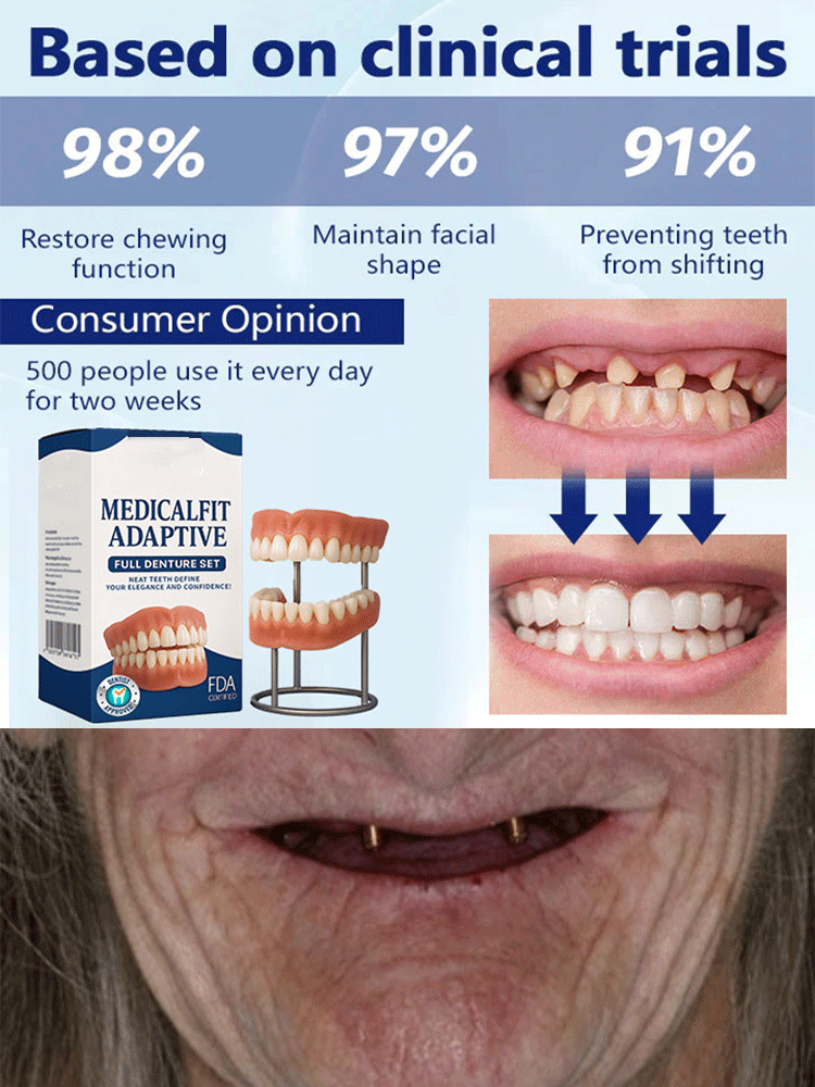 Imported simulation braces, dentists strongly recommend simulation correction braces