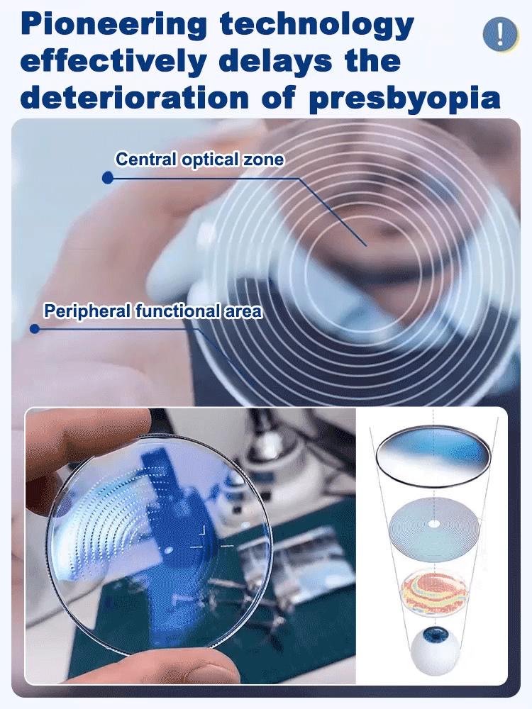 【✨️ Intelligent Zoom from -7.00 to +7.00】Self-adjusting glasses 📎 No eye exam required.
