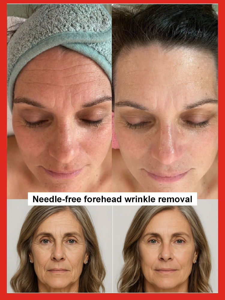 Salmon Water Light Anti-Wrinkle Essence, Feel the lift, see the glow — try it today, risk-free.