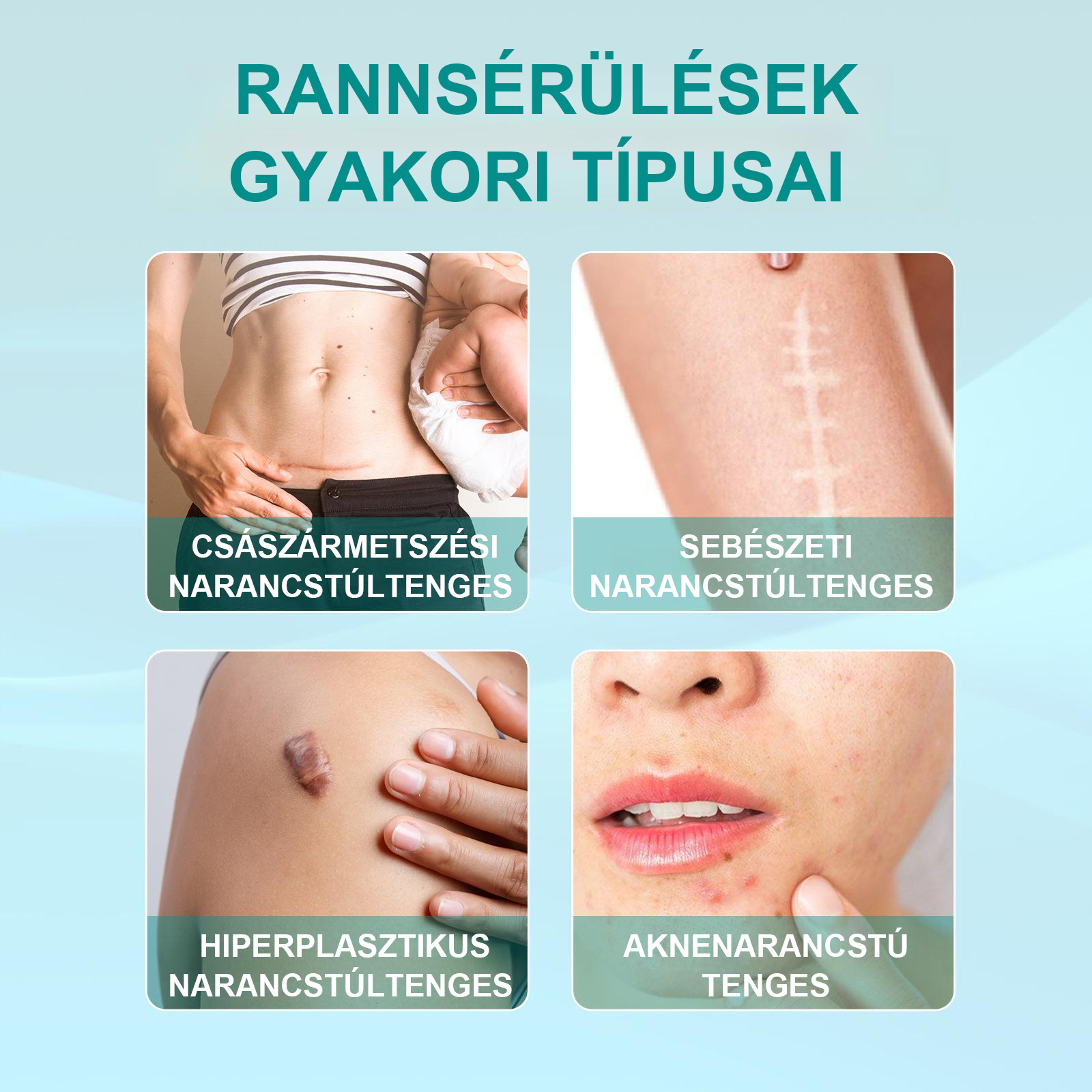 Fivfivgo™ Advanced Scar eltávolító spray