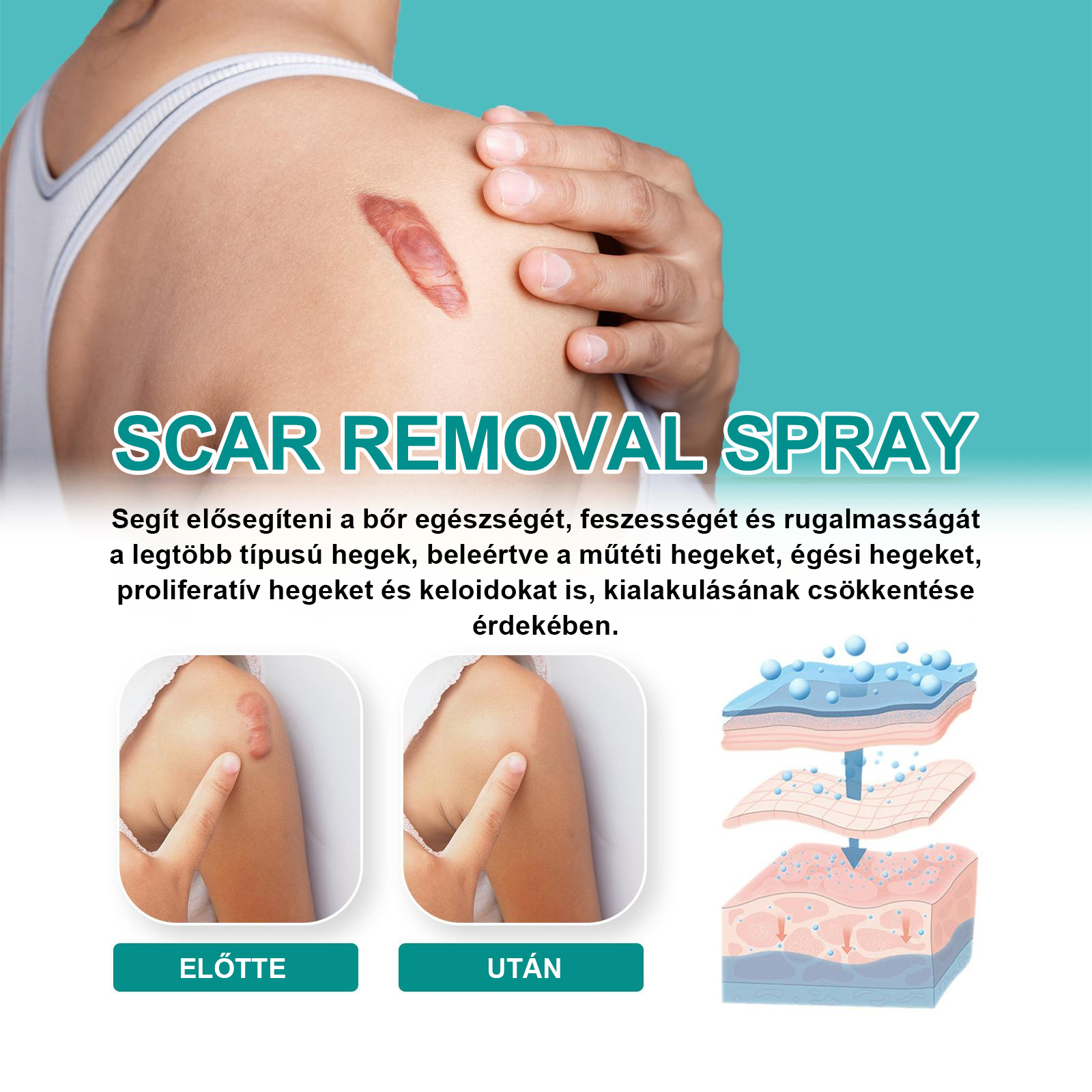 Fivfivgo™ Advanced Scar eltávolító spray