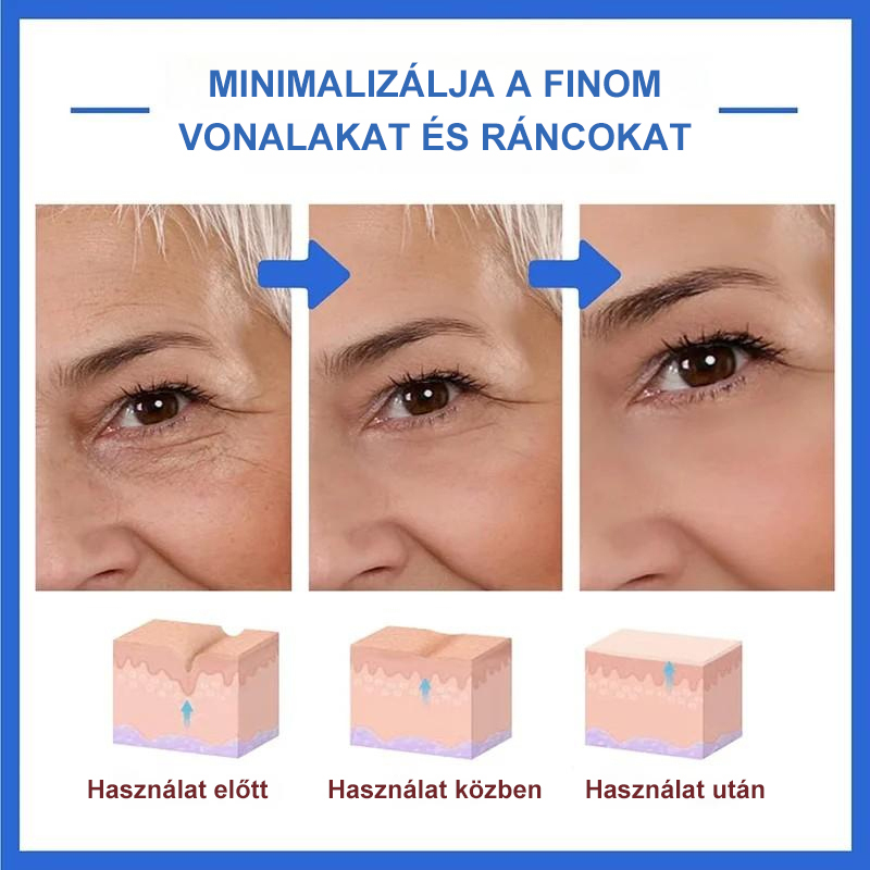 Botox arcszérum-vásárolj többet, spórolj többet