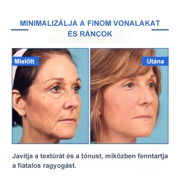 Botox arcszérum-vásárolj többet, spórolj többet