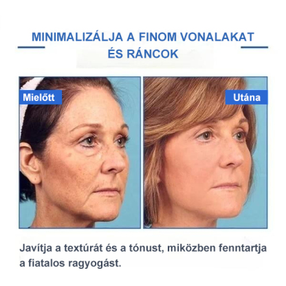 Botox arcszérum-vásárolj többet, spórolj többet