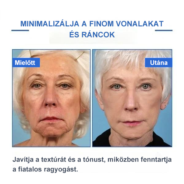 Botox arcszérum-vásárolj többet, spórolj többet