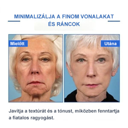 Botox arcszérum-vásárolj többet, spórolj többet