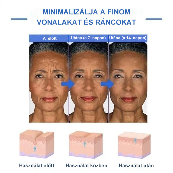 Botox arcszérum-vásárolj többet, spórolj többet