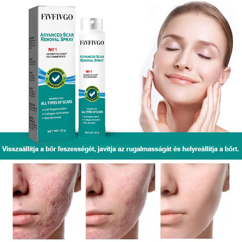 Fivfivgo™ Advanced Scar eltávolító spray
