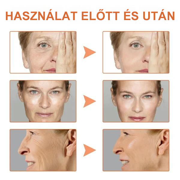 Botox arcszérum-vásárolj többet, spórolj többet