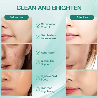 Glycolic Acid Pads - Resurfacing Face Pads with Salicylic Acid ,Reduces Dark Spots, Minimizes Pores for All Skin Types